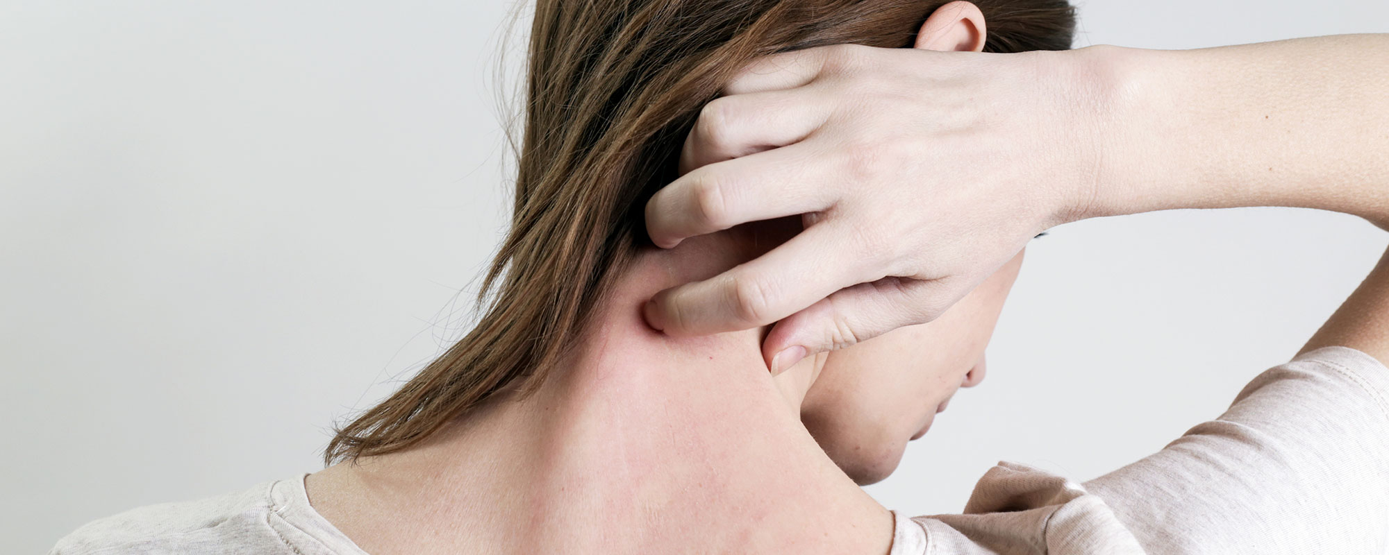 Schuppenflechte (Psoriasis) – Ursachen, Formen und Behandlung